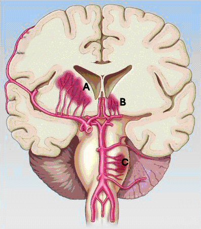 lacunar stroke syndromes